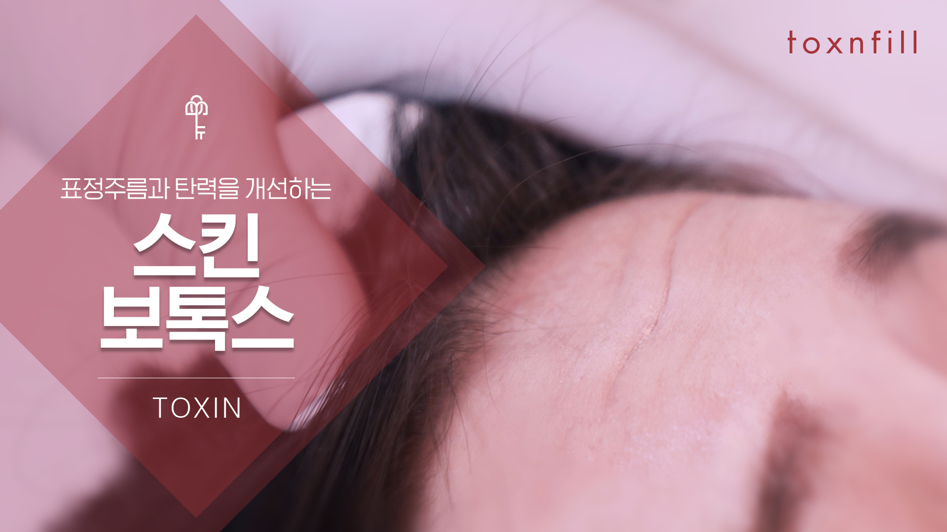 스킨보톡스(더모톡신)