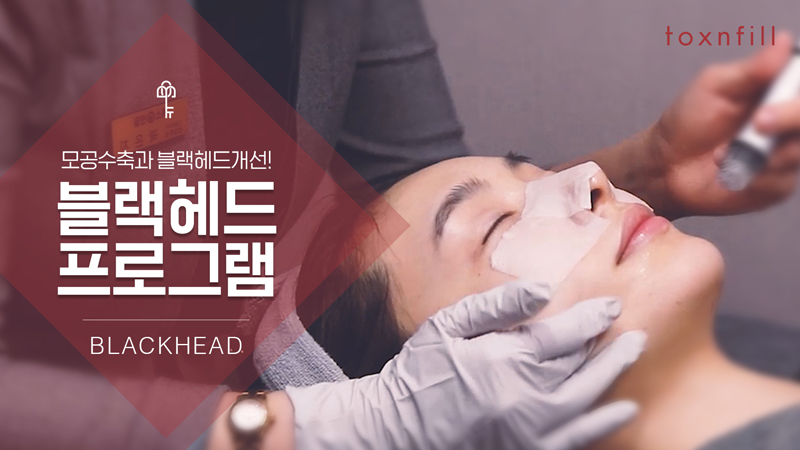 코블랙헤드 프로그램