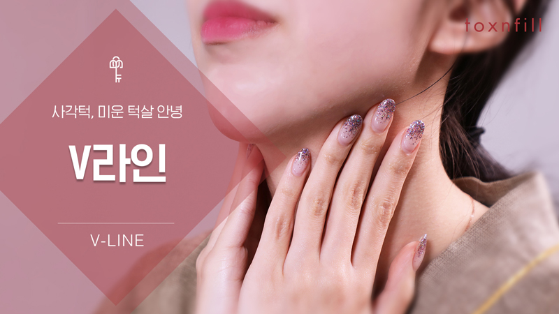 V라인 패키지
