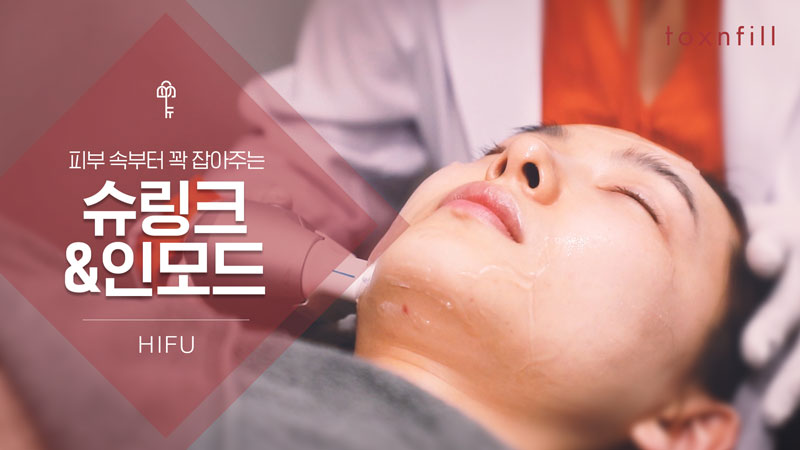 슈모드 트리플 리프팅