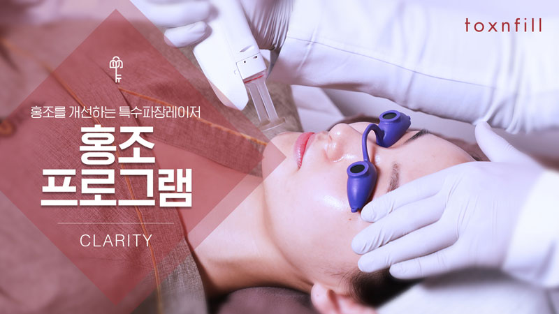 홍조/혈관 패키지