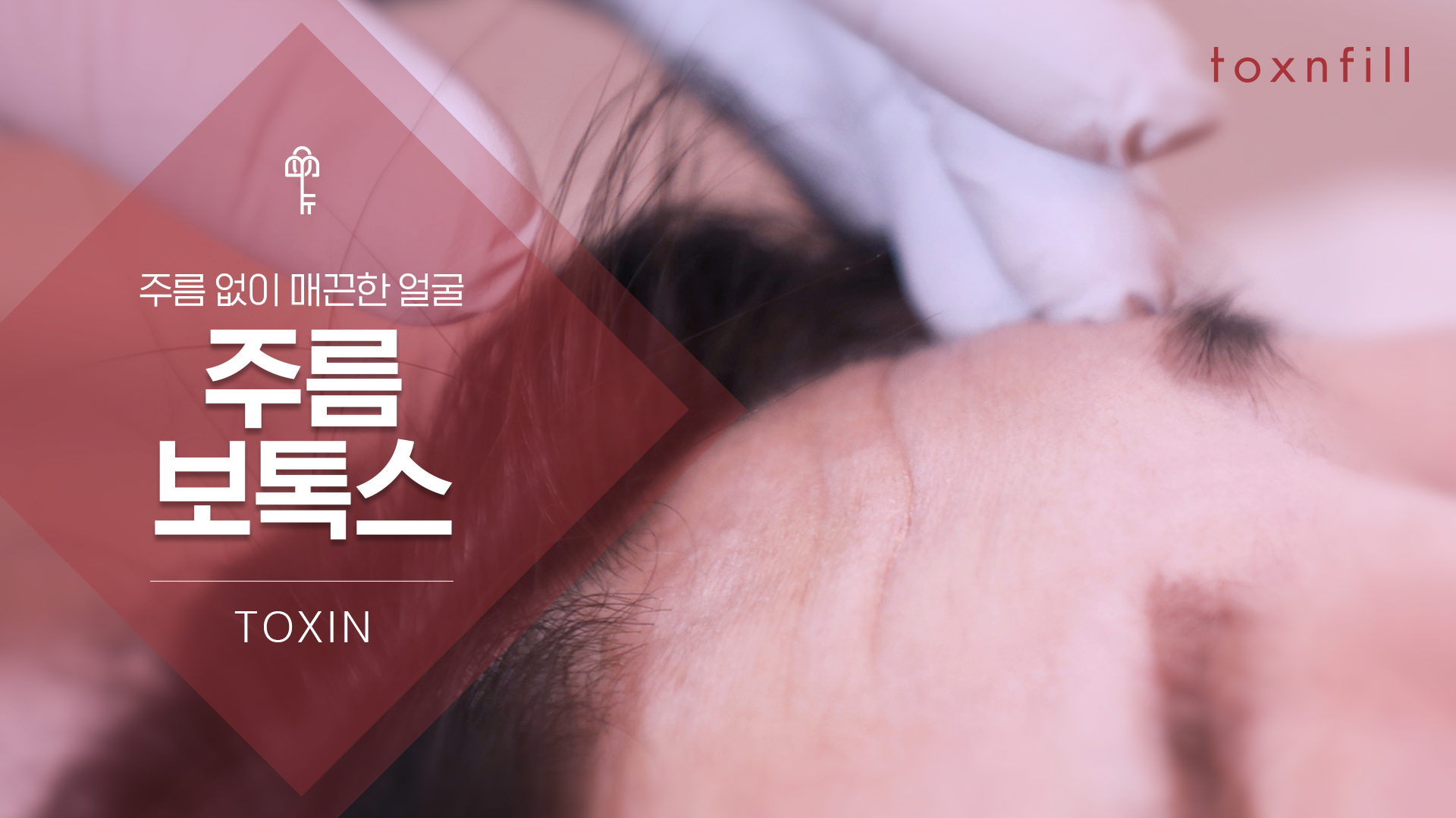 주름보톡스