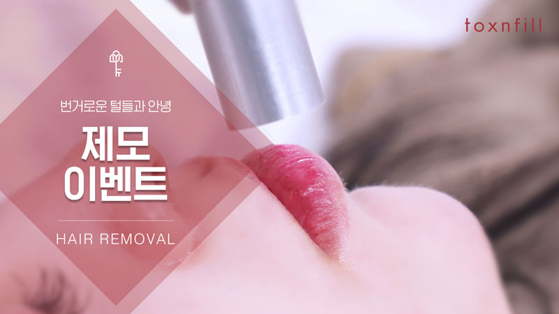 제모 이벤트