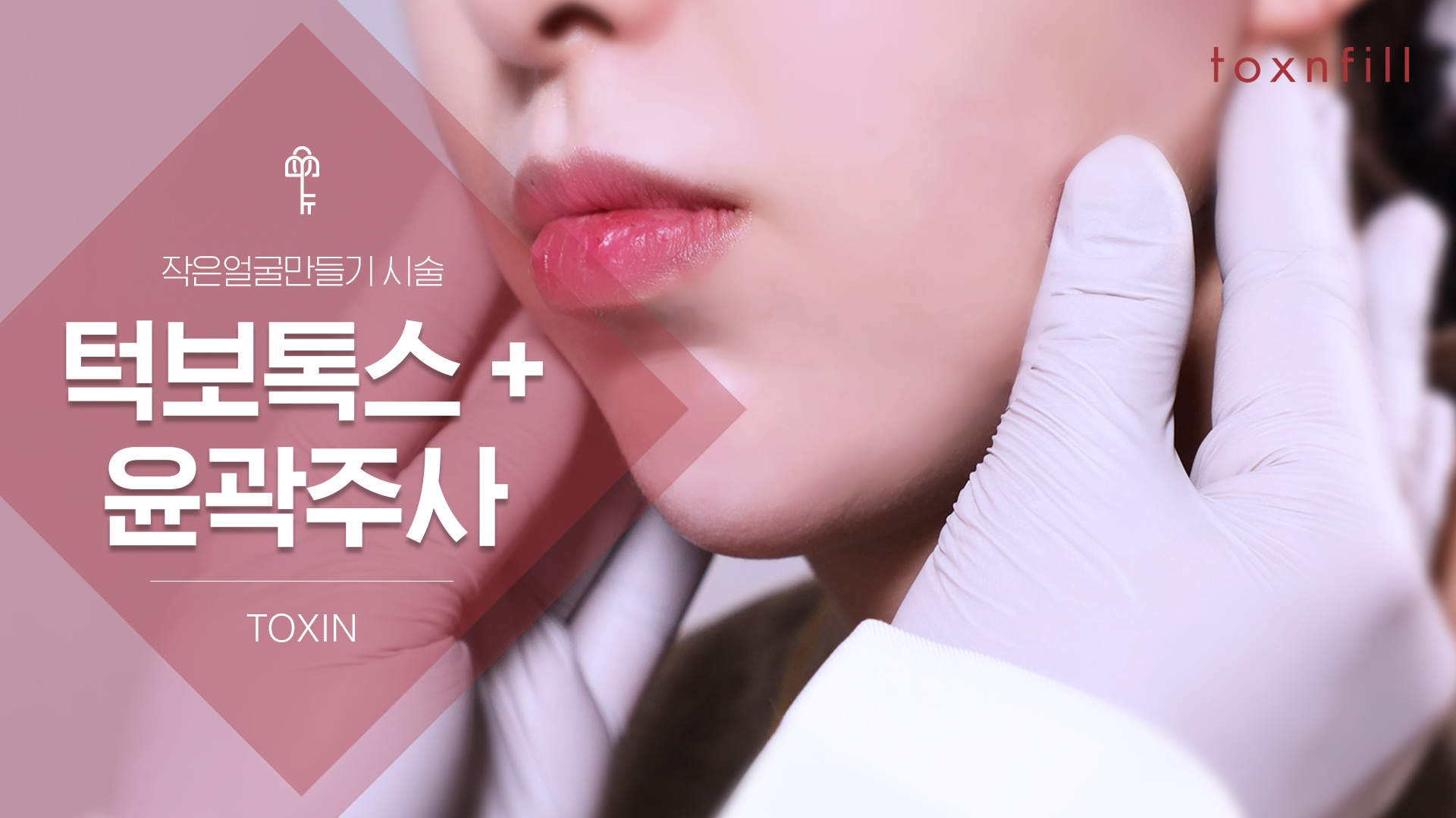 턱보톡스 + 윤곽주사