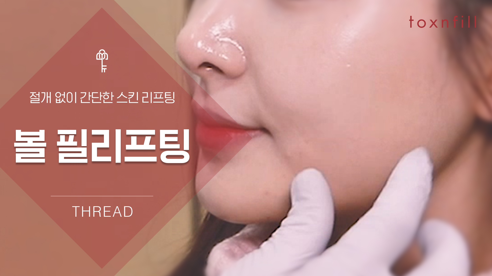 볼 필리프팅