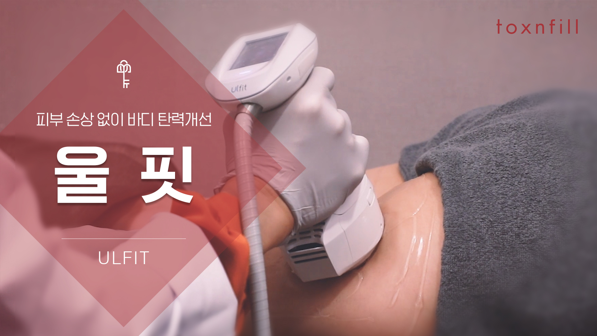 바디리프팅 울핏