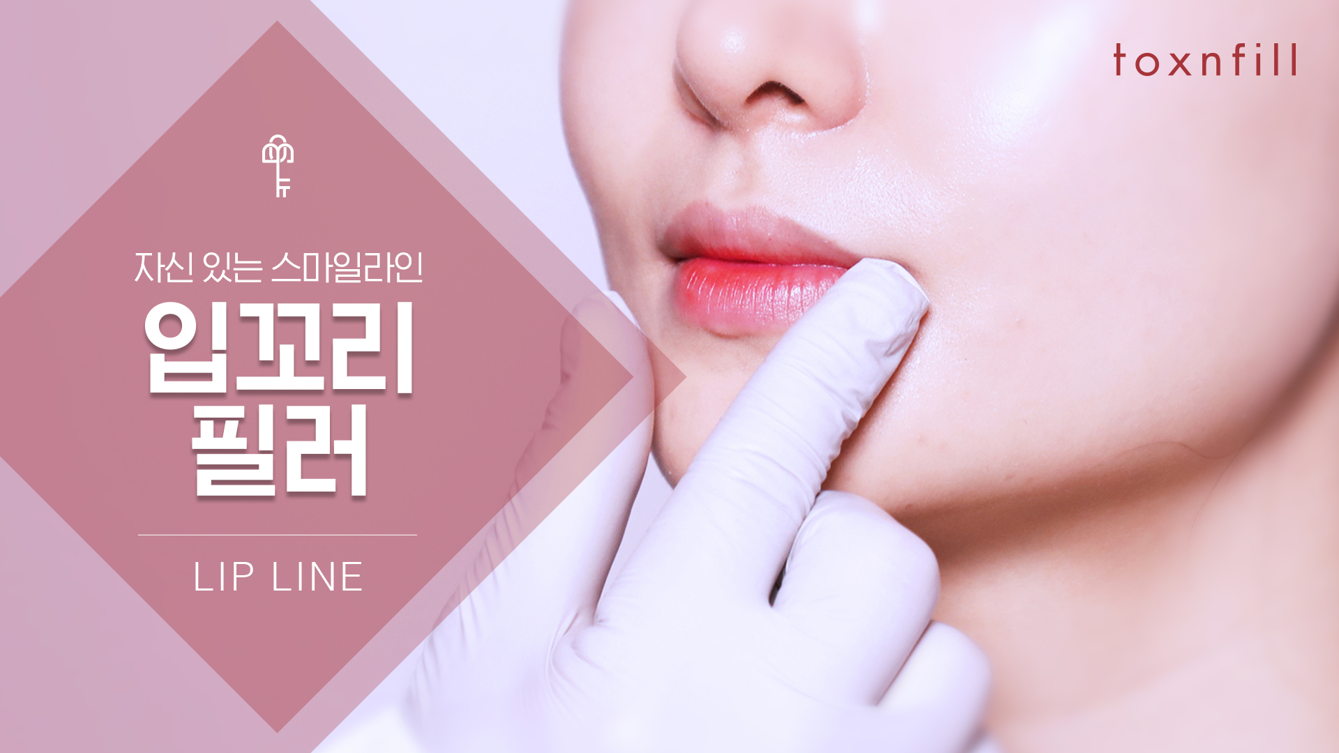 입꼬리필러패키지