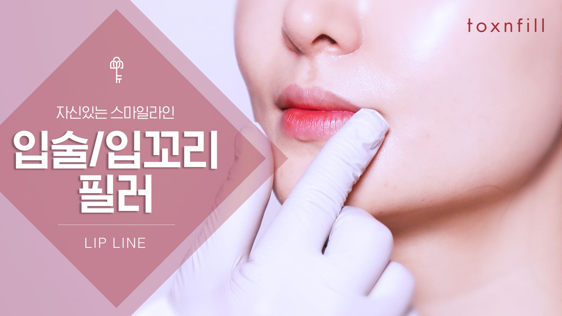 입술/입꼬리 필러