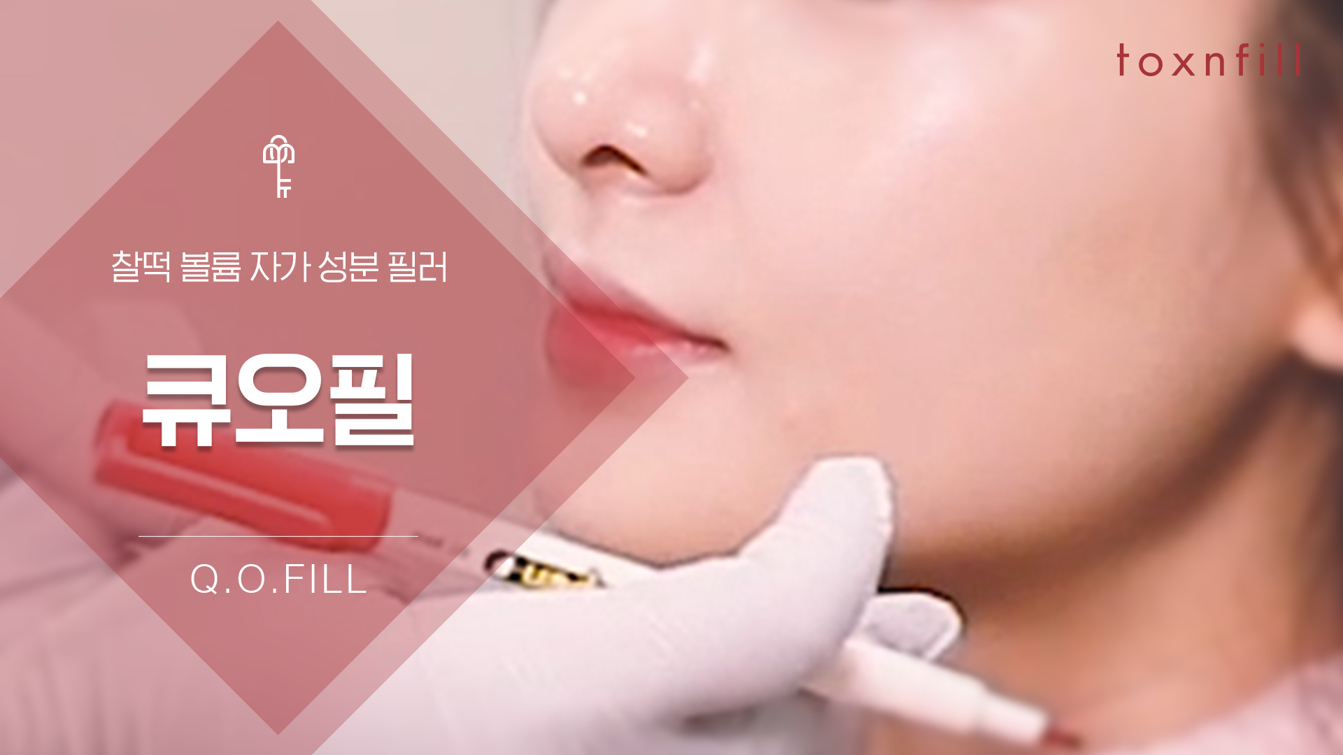 큐오필(Q.O.FILL)