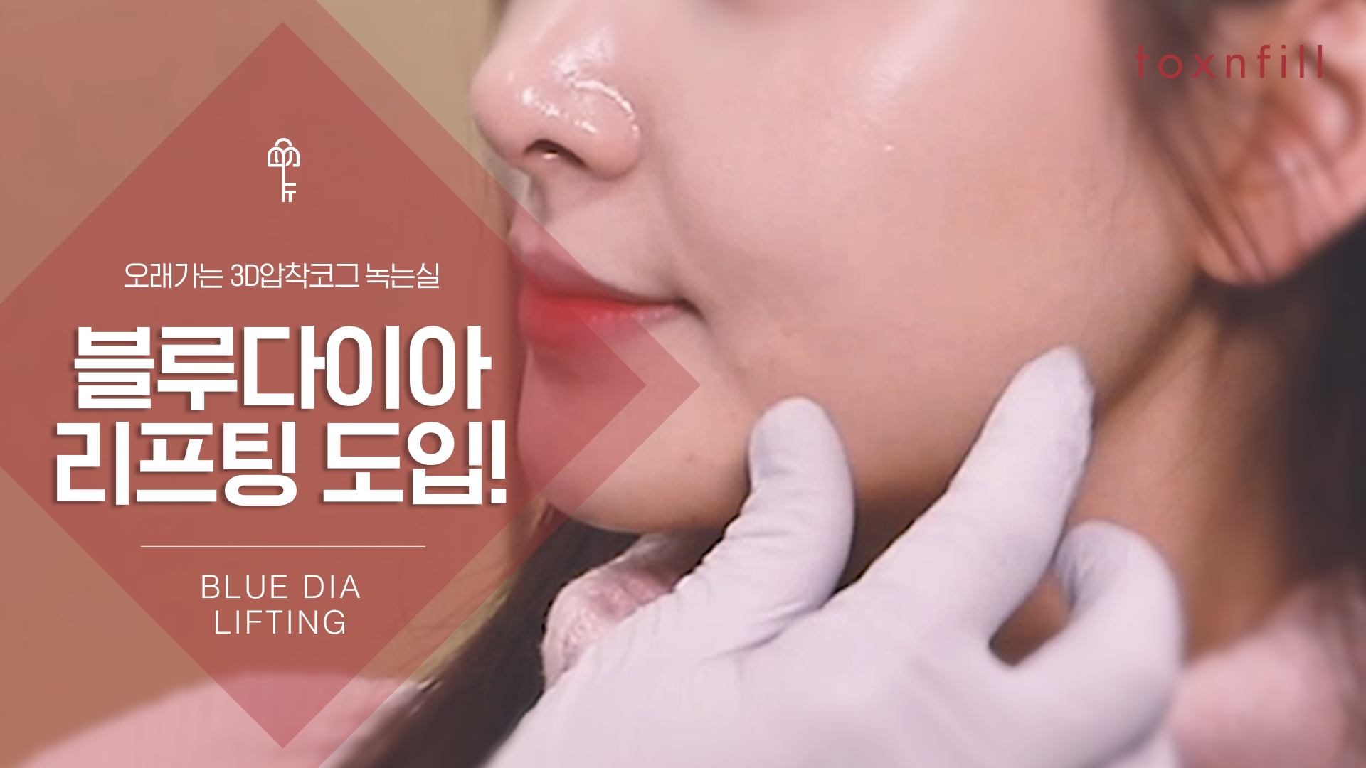 블루다이아 리프팅 도입!