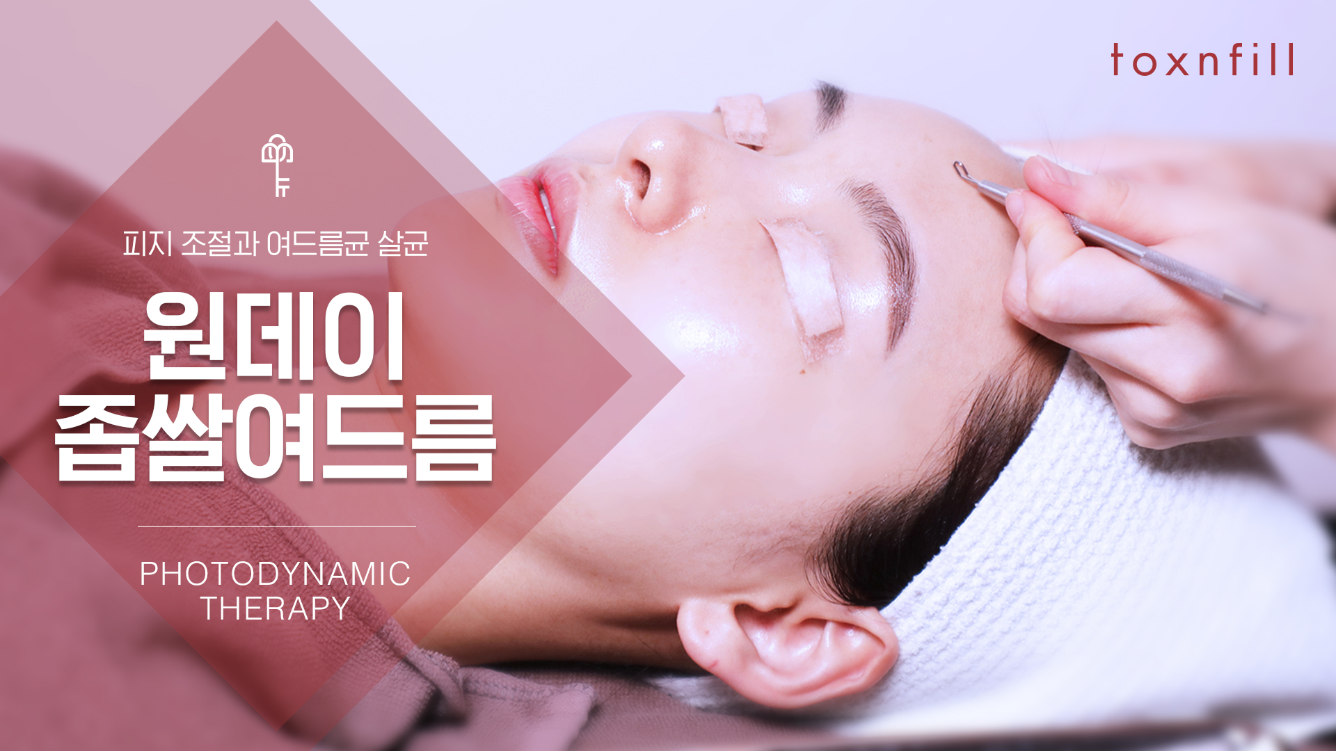 원데이 여드름 패키지