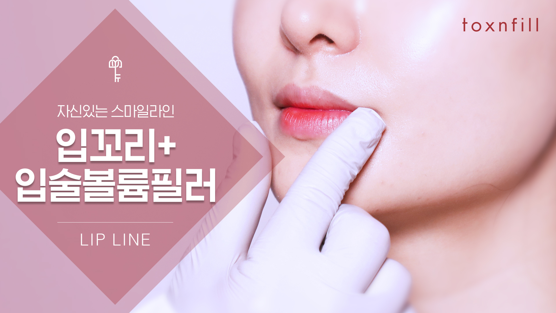 입꼬리필러 패키지