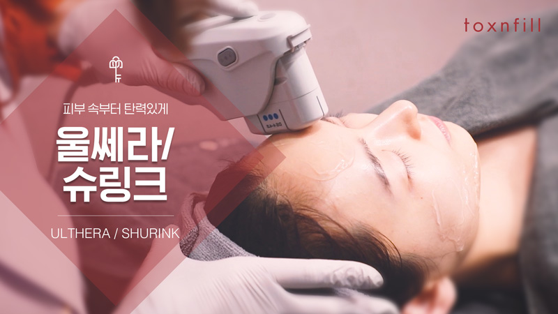 울쎄라/슈링크 이벤트