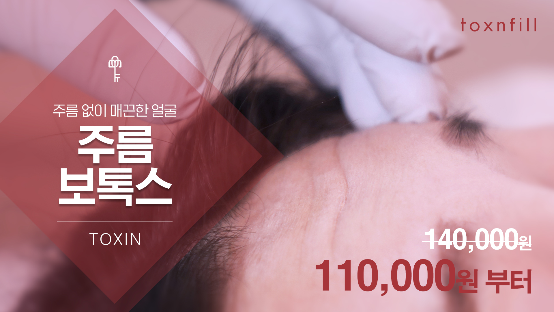 얼굴전체 보톡스 이벤트