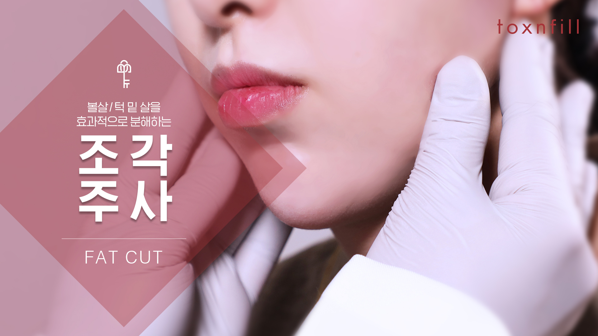 조각주사 이벤트(부위당)