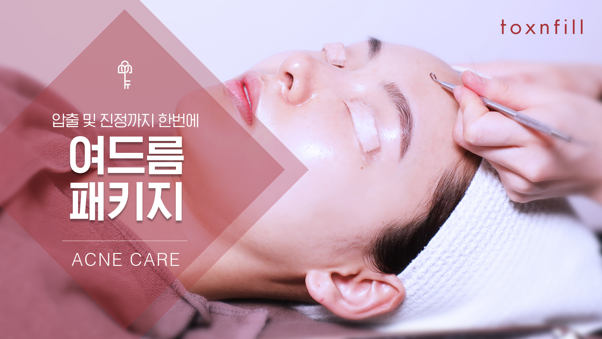 여드름 6주 공략 패키지