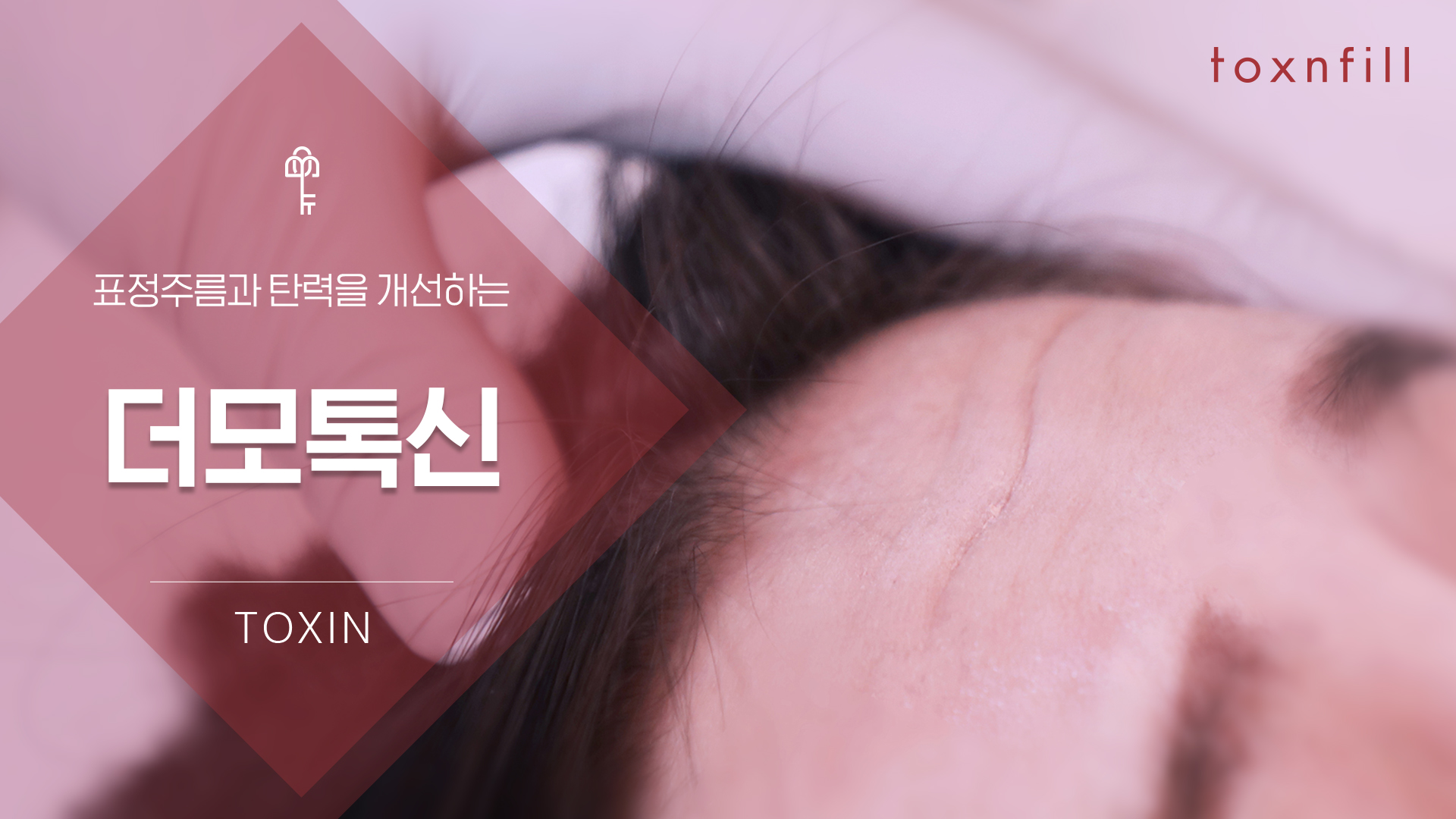 더모톡신
