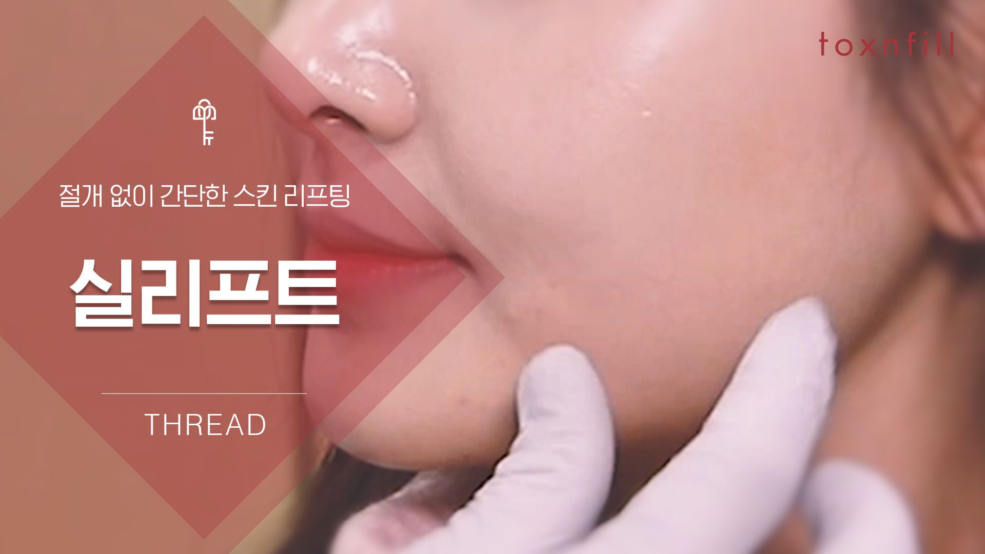 실리프팅